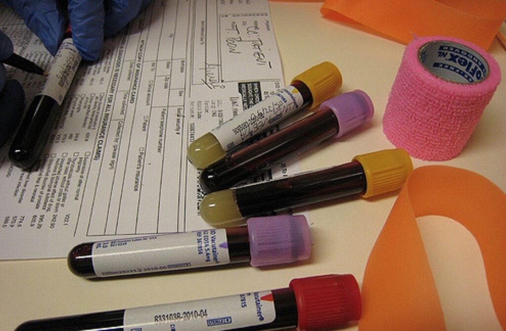 Bloedonderzoek bij eetstoornissen